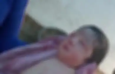 Meski Sangat Sehat Bahkan dari Dalam Kandungan, Bayi Perempuan Ini Lahir Tanpa Lengan dan Kaki hingga Membuat Petugas Medis Bingung, Kok Bisa?
