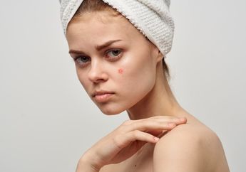 5 Cara Menghilangkan Bekas Jerawat Secara Alami, Bisa Dilakukan Sendiri di Rumah dan Hanya Menggunakan Bumbu Dapur