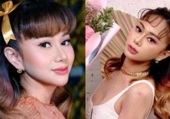 Hamil Tanpa Suami, Denise Chariesta Kini Malah Open Donasi Jelang Lahiran, Kalina Ocktaranny Beri Sentilan Nyelekit