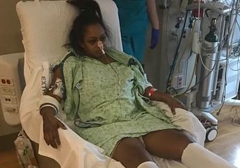 Baru Enam Minggu Melahirkan Langsung Pasang IUD, Wanita Ini Kehilangan Indung Telur Rahim dan Jari-jari Kakinya