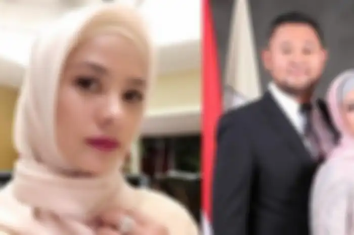 Kondisinya Membaik, Rachel Maryam Sebut Dapat Perawatan Intensif Selama 4 Hari Akibat Pendarahan