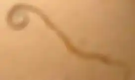 Tetrapodophis amplectus