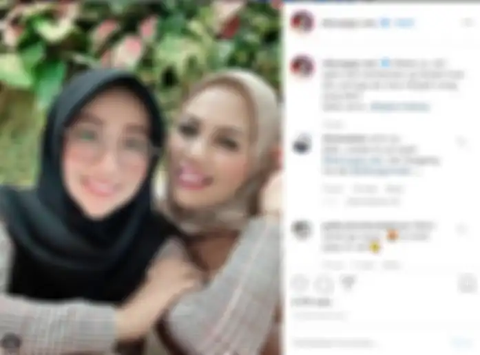 Elly Sugigi potong giginya