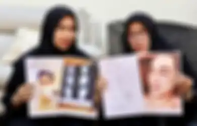 Beberkan Kondisi Anak Semata Wayangnya yang Penuh Luka Parah di Sekujur Tubuhnya, Ibu Rico Valentino Nangis Pilu Minta Keadilan: Kita Lapor Duluan