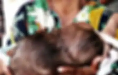 Lahirkan Bayi dengan 2 Kepala Dalam Satu Tubuh, Ibu Ini Ngaku Syok hingga Sempat Ingin Lakukan Ini Saat Mengandung