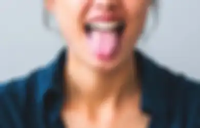 Jarang Diperhatikan, Ternyata Warna Lidah Bisa Bantu Deteksi Penyakit, Inilah 7 Warna Lidah dan Artinya Bagi Kondisi Kesehatan