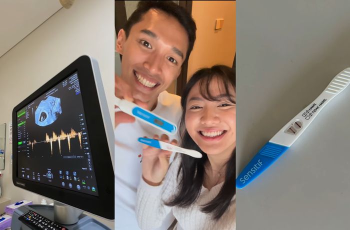 Shanju eks JKT48 umumkan kabar kehamilannya.