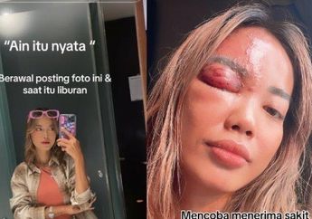 Kena Ain? Wanita di Bali Ini Viral Ngaku Matanya Jadi Begini Usai Posting Foto Ini Saat Liburan: Ain Itu Nyata!