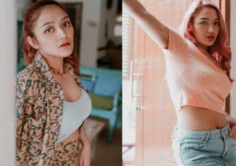 Siti Badriah Idap Tumor Kelenjar Getah Bening, Dikira Jerawat di Ketiak