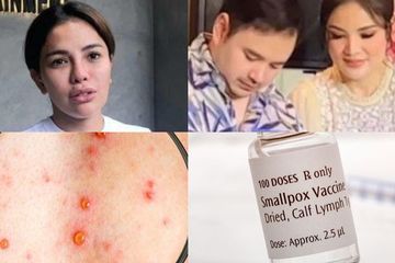 Berita Terpopuler: Nikita Mirzani Batal Ditahan dan Tantang Nindy Ayunda hingga Vaksin untuk Cacar Monyet