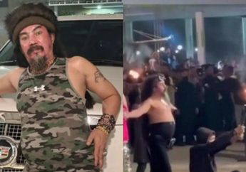 Innalillahi, Detik-detik Jenggot Limbad Terbakar Api, Begini Kondisi sang Pesulap Usai Atraksi Ekstremnya Gagal