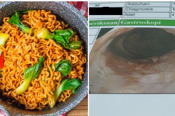 Pria Ini Makan Setengah Kardus Mie Instan Dalam Seminggu, Perubahan Ini Terjadi Langsung dalam Tubuhnya!