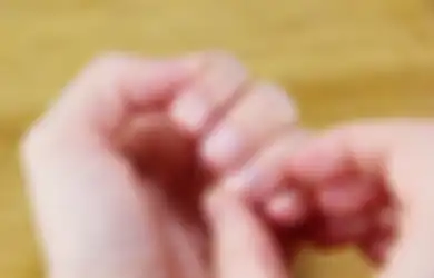 Kenapa Muncul Bintik Putih di Kuku? Bisa Jadi Masalah Serius. Waduh!