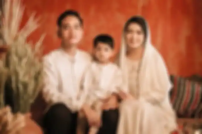 Penampilan Selvi Ananda saat antar Jan Ethes ke dokter gigi curi perhatian