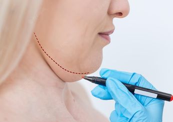 5 Cara Instan Menyamarkan Double Chin  Agar Tampilan Wajah Lebih Proporsional