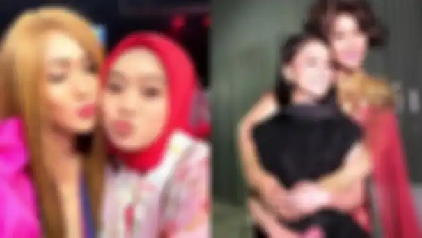 Foto Perubahan Wajah Lesty Kejora Jadi Sorotan, Inul Daratista Langsung Pasang Badan