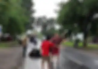 Tragis, Perempuan Terpental di Jalanan Akibat Rok Terlilit Gir Motor, Muka Luka Parah