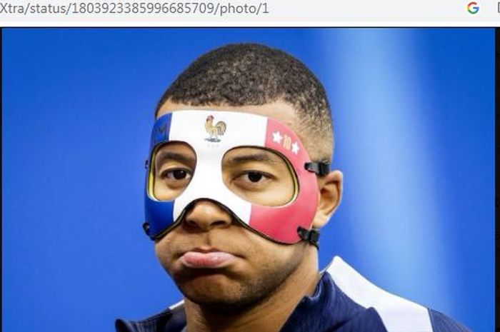 Kapten Timnas Prancis, Kylian Mbappe, mengenakan topeng akibat cedera hidung yang didapatnya pada laga melawan Austria.