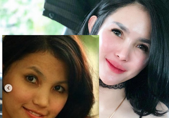 Foto Lawas Beredar, Intan Hardja Dituduh Operasi Plastik: Berbalik 180 Derajat, 3 Orang yang Lakukan Operasi Ini Justru 'Berakhir Mengerikan'