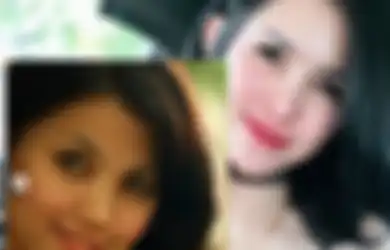  Cantik Tanpa Operasi, Foto Lawas Intan Hardja Beredar, Berbalik 180 Derajat, 3 Orang yang Lakukan Operasi Ini Justru 'Berakhir Mengerikan'