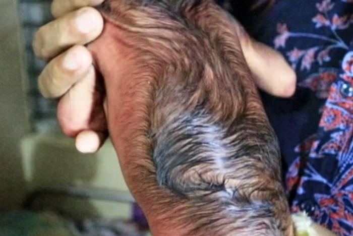 Bagian punggung bayi.