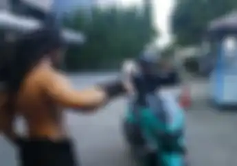 Anggota Brimob Dibegal Di Bekasi, Tangkis Celurit Pakai Tangan Kosong, Begini Kondisinya