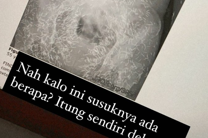 Screen shot penampakan susuk.