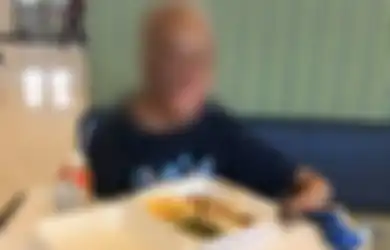 Derita 80 Persen Luka Bakar Saat Bayi, Remaja Ini Tepis Prediksi Dokter dan Bersemangat dalam Hidup Meski Orang 'Takut' Melihatnya