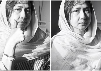 Pasca 10 Kali Radioterapi, Bagaimana Kondisi Ria Irawan? 