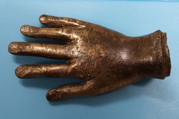 Potongan tangan yang ditemukan di Vindolanda berupa perunggu padat seberat 2,3 kg.