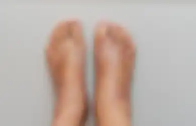 Aneka Tips Kesehatan, Jangan Disepelekan Kaki Bengkak yang Biasa Dialami Penderita Diabetes, Begini Cara Obatinya