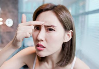 Diet Sehat untuk Menghilangkan Jerawat, Bagaimana Caranya?