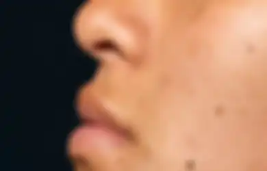 Tips Hidup Bebas Bintik Hitam di Wajah, Cukup Olesi dengan Buah Ini Dijamin Muka Jadi Mulus Anti Kusam