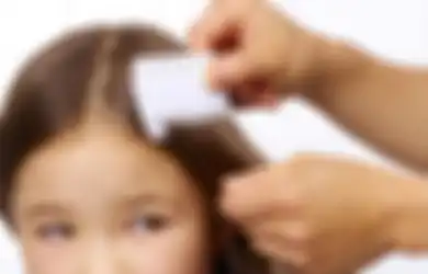 Tips Hidup Menghilangkan Kutu Rambut pada Anak Paling Efektif, Ini Bahan-bahan yang Perlu Dipersiapkan, Lengkap dengan Langkah-langkahnya