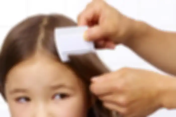 Cara basmi kutu di rambut anak 