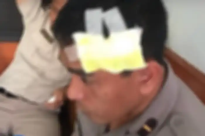 Seorang polisi korban pemukulan perwira menengah polisi.