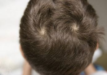 Apa Benar Anak yang Memiliki 2 Unyeng-unyeng Dicap Nakal? Simak Fakta Pusar Rambut, Salah Satunya Bisa Menentukan Karakter Seseorang!
