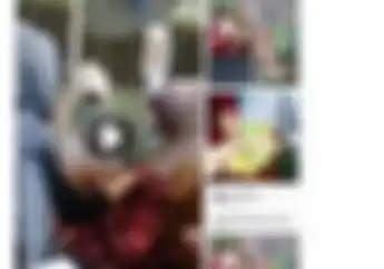 Ya Ampun, Bayi Umur 6 Bulan Putus Kaki Karena Kakinya Nyangkut di Rantai Motor