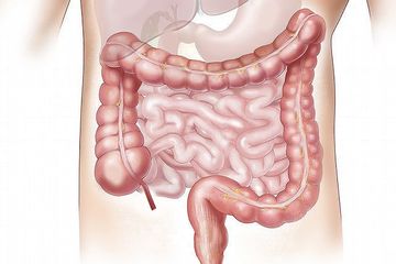 Ternyata di Usus Terdapat Senyawa yang Bisa Menghidupkan Virus Kembali