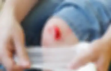 4 Penyebab Luka Susah Sembuh, Bukan Cuma Karena Diabetes Aja!
