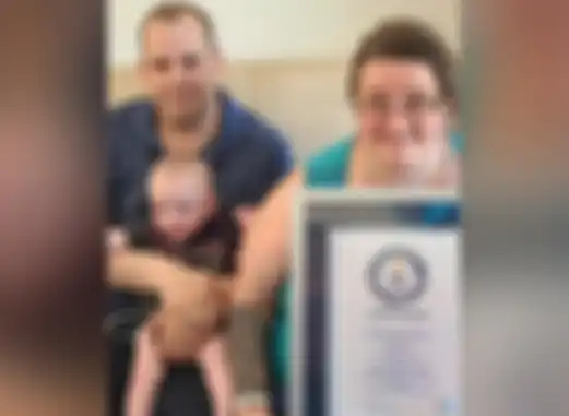 Richard jadi bayi paling prematur yang berhasil bertahan hidup