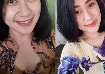 Jadi Korban Pria Tak Dikenal, Perawat di Malang yang Terbakar Api Alami Luka Serius Mencapai 60 Persen di Tubuhnya, Termasuk Wajah dan Dada