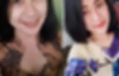 Lagi Istirahat Tiba-tiba Disiram Bensin dan Dibakar Pria Misterius, Intip Potret Eva Sofiana, Perawat Cantik di Malang yang Alami Nasib Tragis