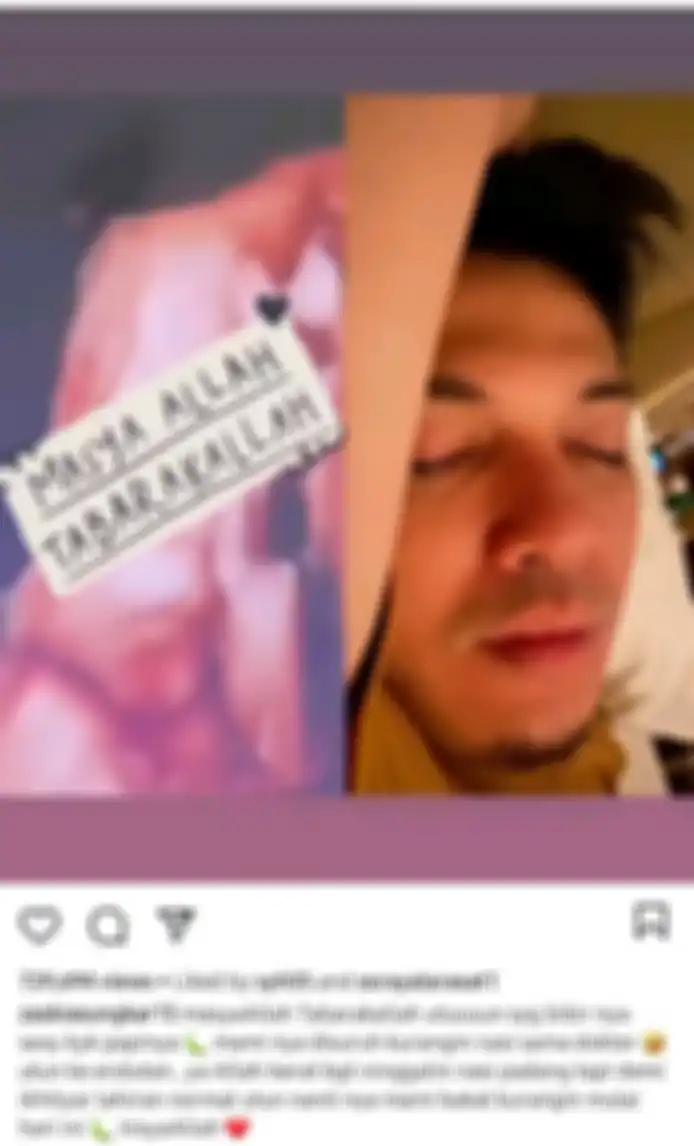 Zaskia Sungkar pamer foto USG kandungannya.