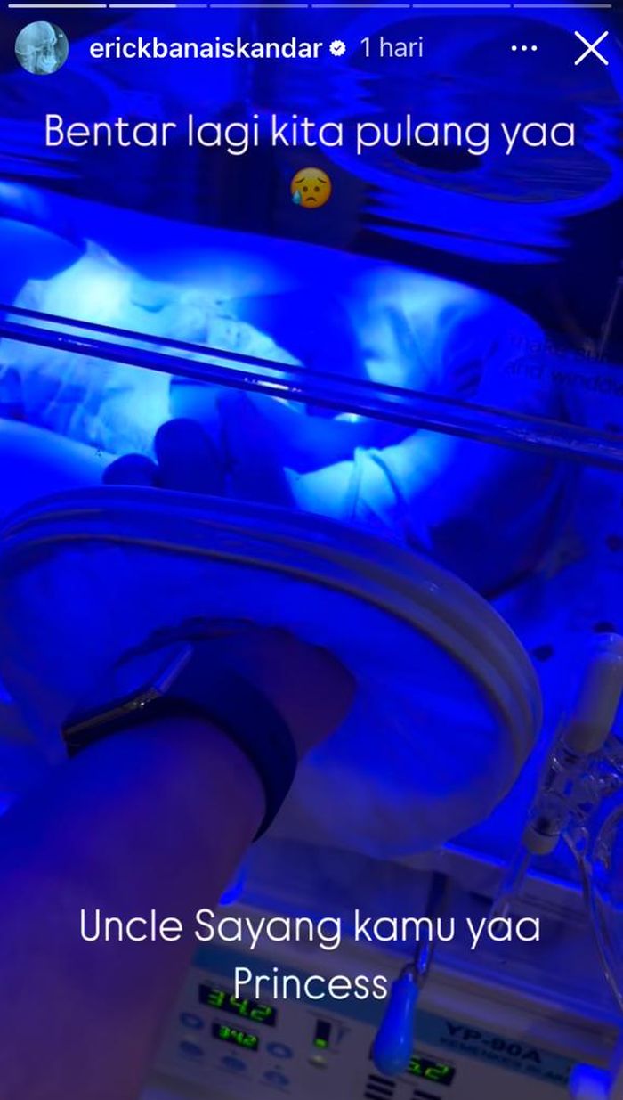Ucapan Erick Iskandar untuk bayi Jessica Iskandar yang jalani terapi sinar UV.