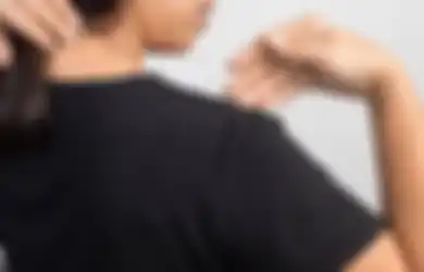 Tips Hidup Bebas Ketombe, Berikut Ini Cara Menghilangkannya Secara Alami dan Permanen