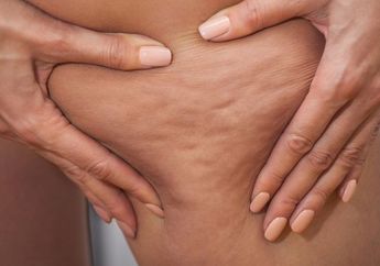 3 Perawatan Selulit yang Sedang Tren di Tahun 2018, Wajib Dicoba nih