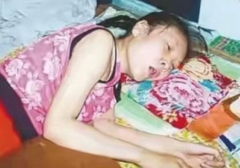 Selama 20 Tahun Lumpuh dan Bergantung kepada Orang Lain, Perempuan Ini Tetiba Bisa Bangun dan Berdiri, sang Kakak Temukan Fakta Mengejutkan Ini