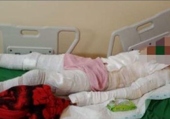 Innalillahi, Bocah SD di Cirebon Terbakar Hidup-hidup hingga Orang Tua Menjerit Syok, Hal Ini Jadi Penyebabnya!