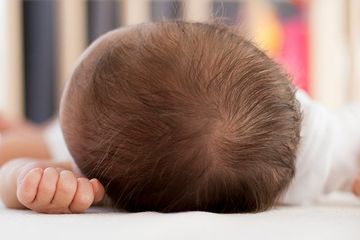 Belasan Bayi di Spanyol Alami Sindrom Manusia Serigala, Apa Penyebabnya? 